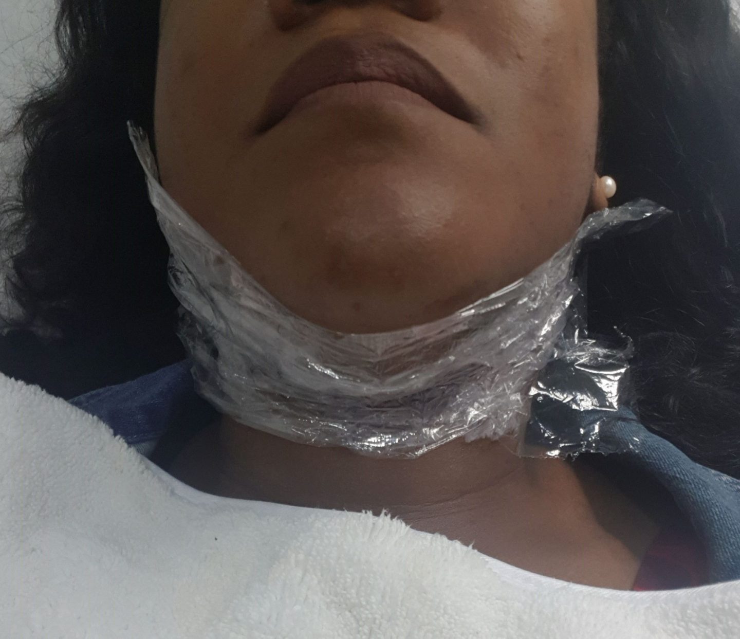 Electrolysis hair removal the good the bad and the ugly Beauty Harbour